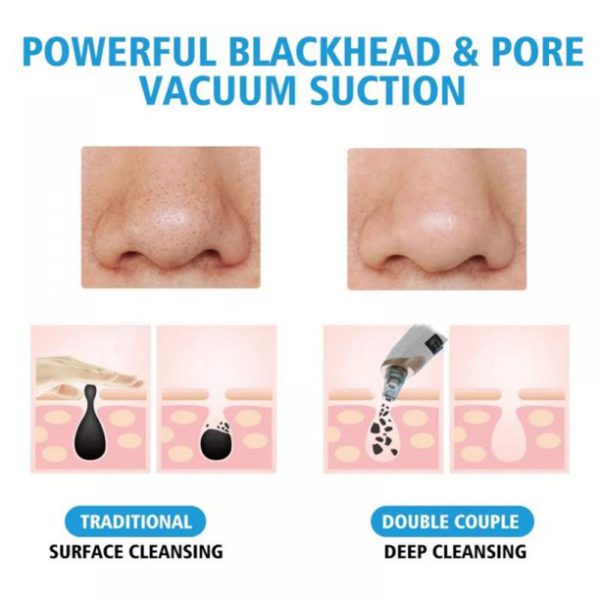 Blackhead Suction Remover Pore Vacuum | Blackhead Pore Cleaning Beauty Tool