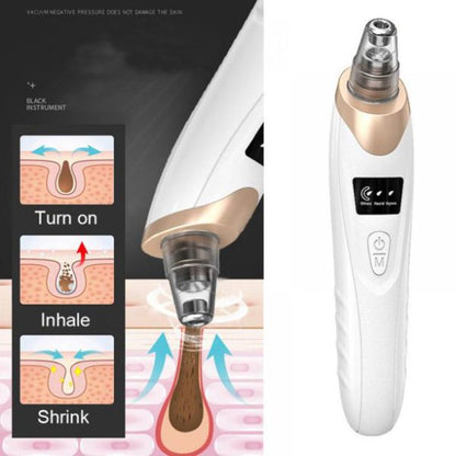 Blackhead Suction Remover Pore Vacuum | Blackhead Pore Cleaning Beauty Tool